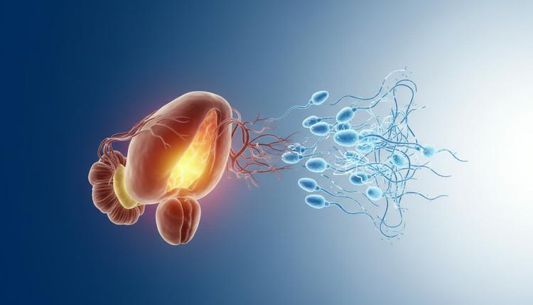 Chronic Prostatitis and Its Impact on Fertility: What You Need to Know