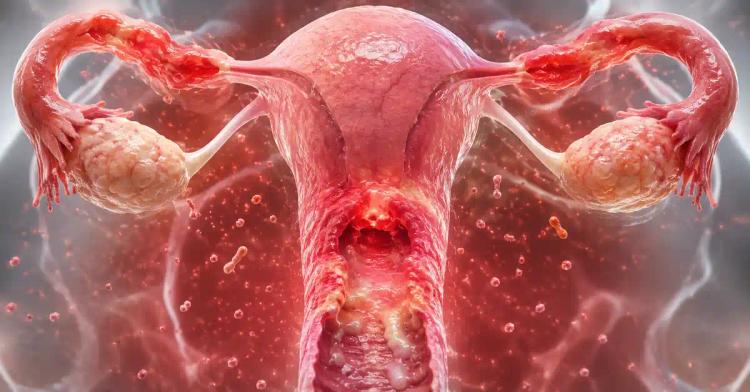 Vaginal And Pelvic Infections: Can They Cause Infertility?